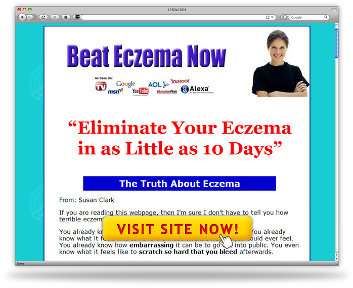 Beat Eczema Now